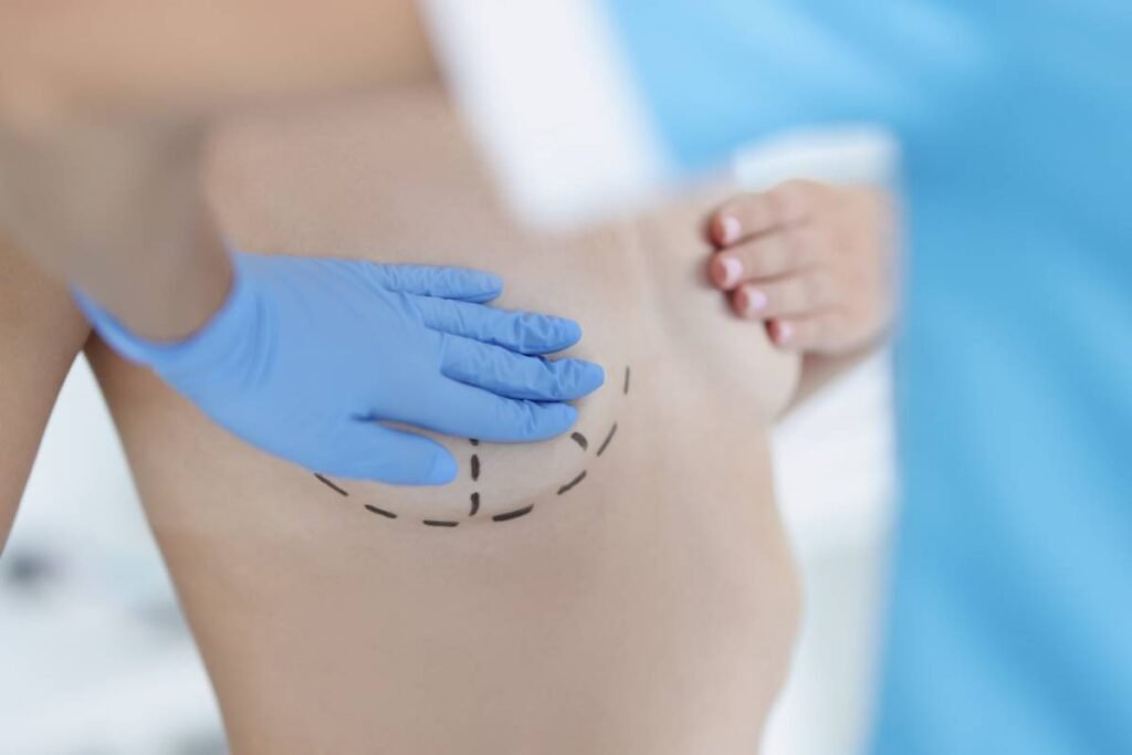 Chirurgie mammaire à Lyon